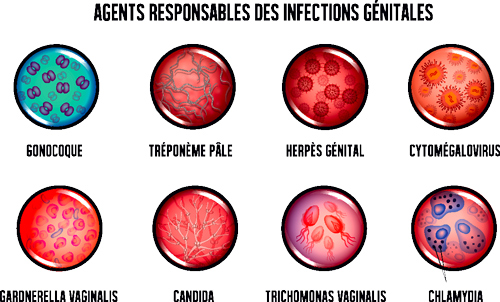 Quelles sont les IST les plus courantes ?