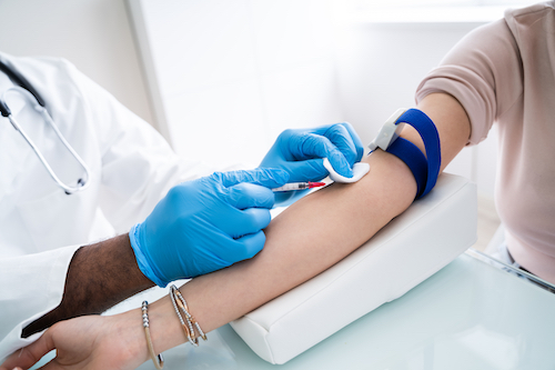 Quelles sont les IST les plus courantes ?