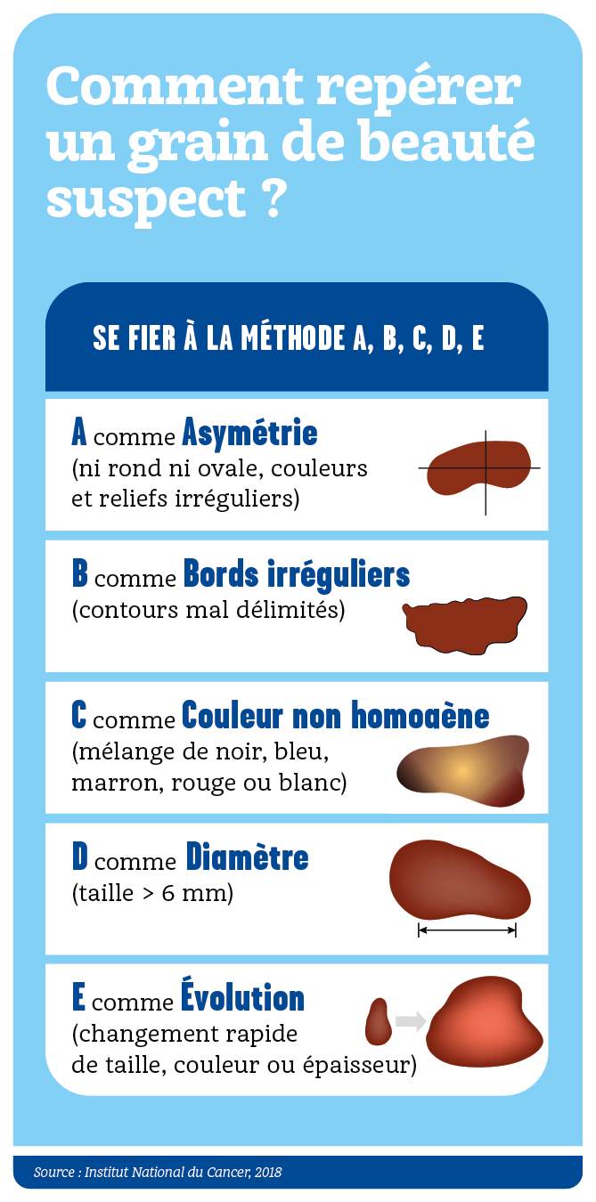 Grain de beauté : quand faut-il s’inquiéter ?