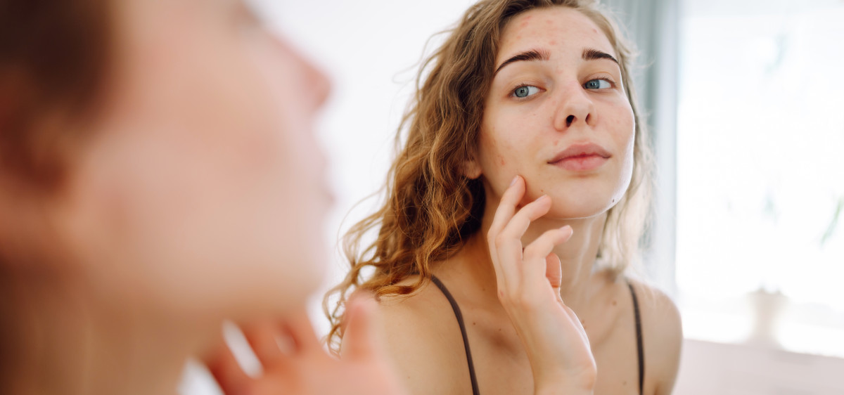 Peaux atopiques : vrai/faux sur les idées reçues